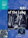 MRI of the Lung (Medical Radiology / Diagnostic Imaging)