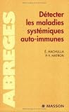 D�tecter les maladies syst�miques auto-immunes