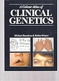 A colour atlas of clinical genetics