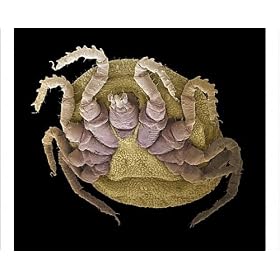 Photographic Prints of Sheep tick, SEM from Science Photo Library