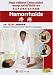 Simple traditional Chinese medical massage and self health care--Hemorrhoids