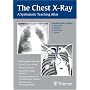 The Chest X-Ray: A Systematic Teaching Atlas