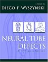 Neural Tube Defects: From Origin to Treatment