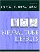 Book Neural Tube Defects: From Origin to Treatment