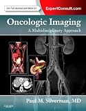 Oncologic Imaging: A Multidisciplinary Approach: Expert Consult - Online and Print, 1e