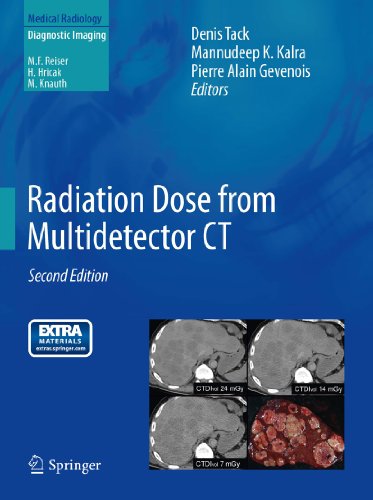 Radiation Dose from Multidetector CT (Medical Radiology)