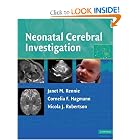 Click here to buy Neonatal Cerebral Investigation by Janet M. Rennie, Cornelia F. Hagmann, and Nicola J. Robertson.