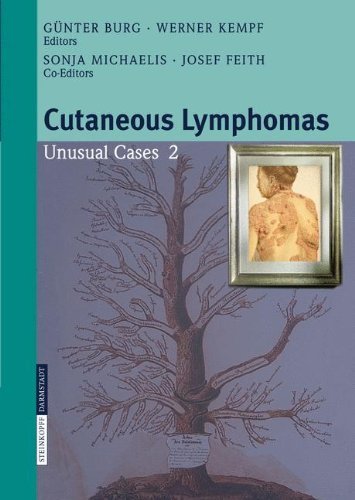 Cutaneous Lymphomas: v. 2