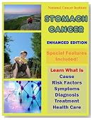 Stomach Cancer - Enhanced Edition: Learn What Is Cause, Risk Factors, Symptoms, Diagnosis, Treatment and Health Care (Annotated and Illustrated)