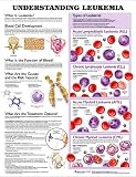 Understanding Leukemia Anatomical Chart