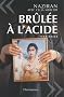 Br�l�e � l'acide