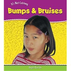 Bumps and Bruises (It's Not Catching)