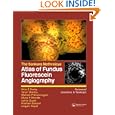 Atlas of Fundus Fluorescein Angiography