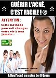 Guérir l’acné, c’est facile !