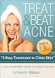 Treat Beat Acne The 3 Step Treatment to
