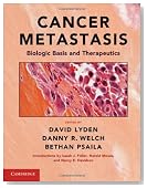 Cancer Metastasis: Biologic Basis and Therapeutics
