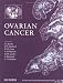 Ovarian Cancer: State of the Art and New Developments