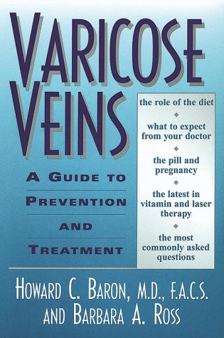 Varicose-Veins