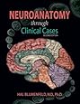 Neuroanatomy Through Clinical Cases, Second Edition, Text with Interactive eBook (Blumenfeld, Neuroanatomy Through Clinical Cases)