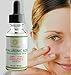 Ácido Hialurónico El Mejor Suero Anti-Envejecimiento Para La Piel Clínicamente Comprobado- Suero Anti-Arrugas Con Vitamina C + Vitamina E + Te Verde + Aceite de Jojoba 100% Orgánico 1 oz.