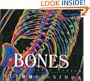Bones: Our Skeletal System (Human Body)