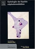 Cytologie du liquide c�phalorachidien