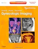 Gynecologic Imaging: Expert Radiology Series (Expert Consult Premium Edition - Enhanced Online Features and Print), 1e