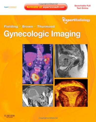 Textbook - Gynecologic Imaging: Expert Radiology Series (Expert Consult Premium Edition - Enhanced Online Features and Print), 1e