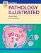 Pathology Illustrated