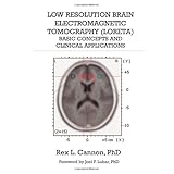 low resolution brain electromagnetic tomography loreta basic concepts and clinical applications