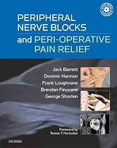 Peripheral Nerve Blocks and Peri-operative Pain Relief