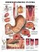 Book Understanding Ulcers (Teach & Learn)