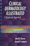  : Clinical Dermatology Illustrated: A Regional Approach