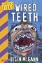 Wired Teeth (Forbidden Files)