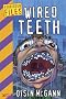 Wired Teeth (Forbidden Files)