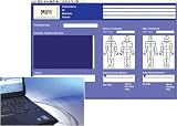 Chattanooga Intelect Legend XT Patient Data Management System