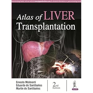 Atlas of Liver Transplantation