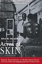 Acres of Skin