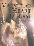 Valvular Heart Disease