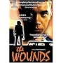 The Wounds