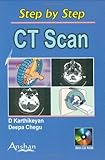 CT Scan (Step by Step)