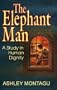 The Elephant Man: A Study in Human Dignity