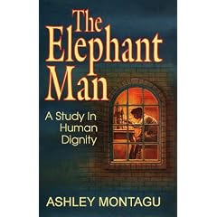 The Elephant Man: A Study in Human Dignity