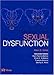 Male and Female Sexual Dysfunction