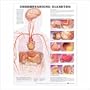 Understanding Diabetes Anatomical Chart 20" X 26" Laminated