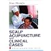 Scalp Acupuncture and Clinical Cases