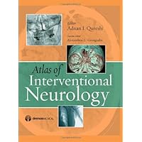 Atlas of Interventional Neurology