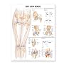 Hip and Knee