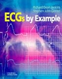 Ecgs by Example