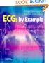 ECGs by Example, 1e